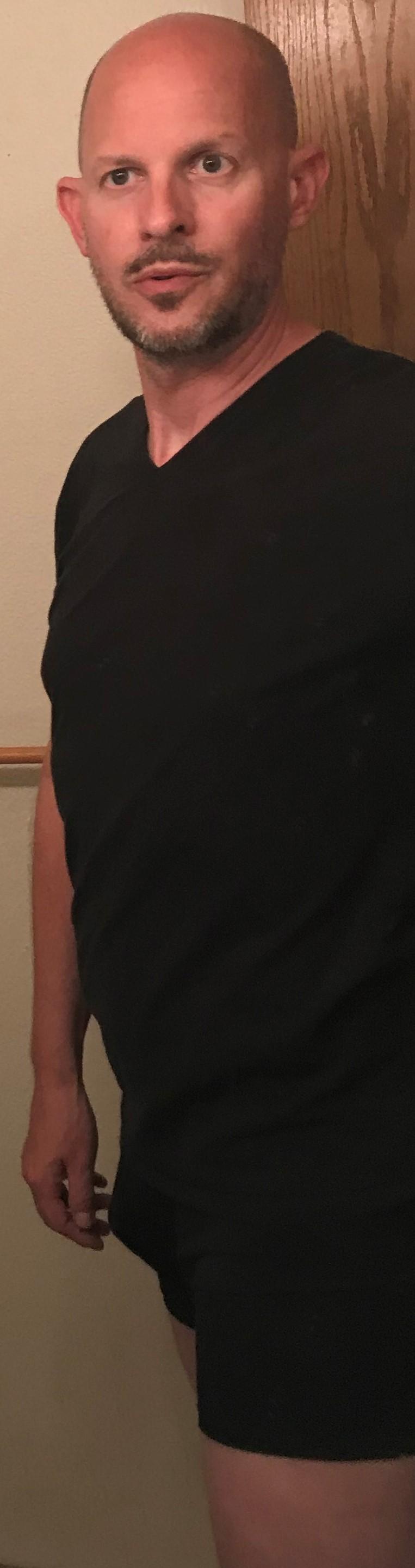 1hotbaldguy live